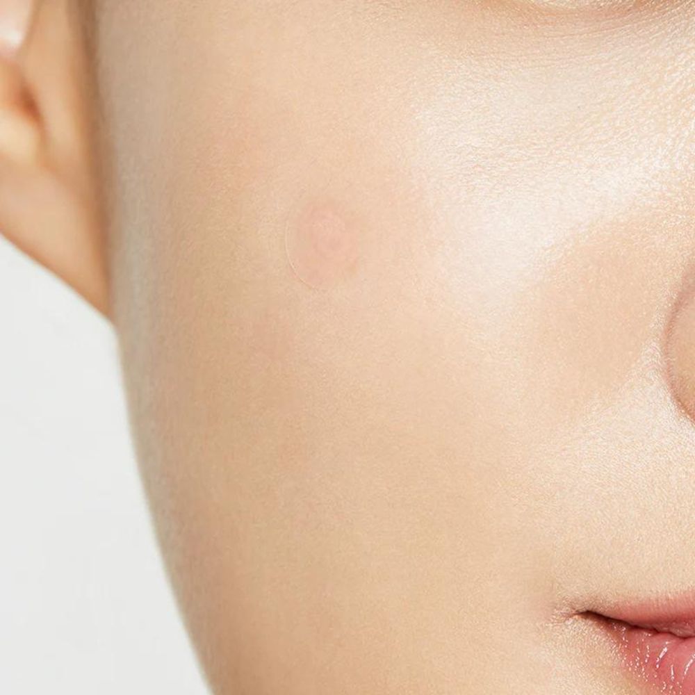 CosRX Clear Fit Master Patch Treatment for Breakouts
